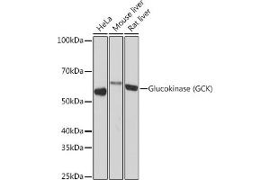 Western blot analysis of extracts of various cell lines, using Glucokinase (GCK) (GCK) Rabbit mAb (ABIN7267396) at 1:1000 dilution. (GCK Antikörper)