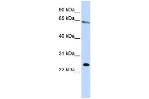 Western Blotting (WB) image for anti-Zinc Finger Protein 326 (ZNF326) antibody (ABIN2458467) (ZNF326 Antikörper)