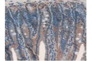IHC-P analysis of Rat Intestine Tissue, with DAB staining. (IL17RD Antikörper  (AA 356-605))