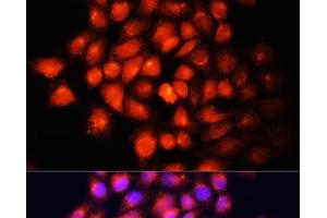 Immunofluorescence analysis of HeLa cells using IGF2 Polyclonal Antibody at dilution of 1:100 (40x lens). (IGF2 Antikörper)