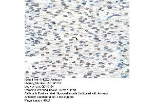 Rabbit Anti-THOC3 Antibody  Paraffin Embedded Tissue: Human Heart Cellular Data: Myocardial cells Antibody Concentration: 4. (THO Complex 3 Antikörper  (Middle Region))