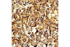 Immunohistochemical analysis of Arylsulfatase G staining in human pancreas formalin fixed paraffin embedded tissue section. (ARSG Antikörper)