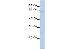 WB Suggested Anti-SOX30 Antibody Titration:  0.