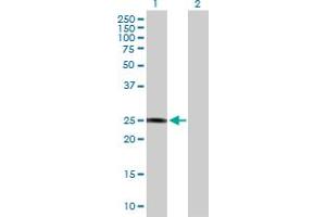 Western Blot analysis of GSTZ1 expression in transfected 293T cell line by GSTZ1 MaxPab polyclonal antibody.