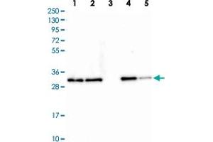 Western blot analysis of Lane 1: Human cell line RT-4 Lane 2: Human cell line U-251MG Lane 3: Human plasma Lane 4: Human liver tissue Lane 5: Human tonsil tissue with CLTA polyclonal antibody  at 1:250-1:500 dilution. (CLTA Antikörper)