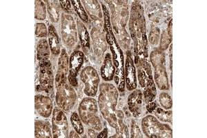 Immunohistochemical staining of human kidney with WDR23 polyclonal antibody  shows moderate to strong positivity in tubular cells at 1:20-1:50 dilution. (DCAF11 Antikörper)