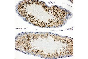 Immunohistochemistry (IHC) image for anti-Hepatitis A Virus Cellular Receptor 1 (HAVCR1) (AA 289-307), (C-Term) antibody (ABIN3044229)