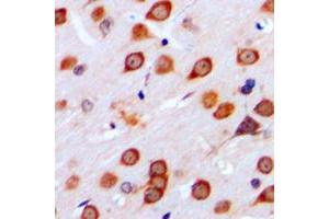 Immunohistochemical analysis of mGLUR4 staining in human brain formalin fixed paraffin embedded tissue section. (Metabotropic Glutamate Receptor 4 Antikörper  (C-Term))