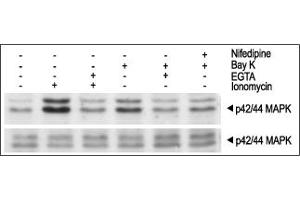 Cells were preincubated with or without EGTA or Nifedipine for 20 min then stimulated with (±)-Bay K8644 (ABIN7885716) or with Ionomycin for 10 min. ((±)-Bay K8644)