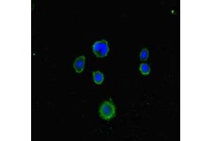 Immunofluorescent analysis of MCF-7 cells using ABIN7158049 at dilution of 1:100 and Alexa Fluor 488-congugated AffiniPure Goat Anti-Rabbit IgG(H+L) (LRCH1 Antikörper  (AA 1-105))