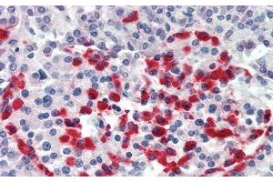 Immunohistochemistry (IHC) image for anti-Integrin beta-6 (ITGB6) (AA 131-371) antibody (ABIN7434668)