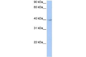 WB Suggested Anti-ZBTB6 Antibody Titration:  0. (ZBTB6 Antikörper  (Middle Region))
