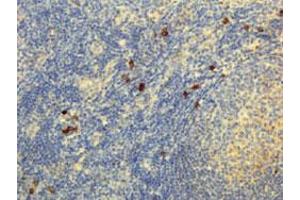 Immunohistochemical staining (Formalin-fixed paraffin-embedded sections) of human lymphoid tissue with Human IgG4 monoclonal antibody, clone RM120  under 5 ug/mL working concentration. (Kaninchen anti-Human Immunoglobulin Heavy Constant gamma 4 (G4m Marker) (IGHG4) Antikörper)