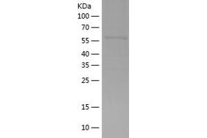 PPP1R3A Protein (AA 1-323) (His-IF2DI Tag)