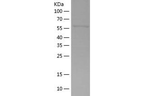 PPP1R3A Protein (AA 1-323) (His-IF2DI Tag)