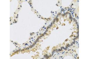 Immunohistochemistry of paraffin-embedded Rat lung using RSPO1 Polyclonal Antibody at dilution of 1:100 (40x lens). (RSPO1 Antikörper)