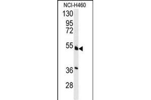 Western blot analysis of anti-HNF4A Antibody  (ABIN389268 and ABIN2839401) in NCI- cell line lysates (35 μg/lane). (HNF4A Antikörper  (AA 118-146))