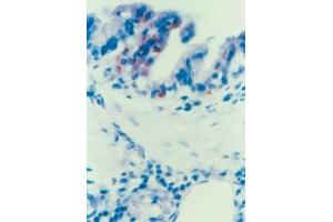 Immunohistochemical staining of Parainfluenza Typ 3 (PIV-3) in Lung epithelial cells (Guinea pig) (Parainfluenza Virus Type 3 Antikörper)