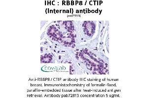 Image no. 1 for anti-Retinoblastoma Binding Protein 8 (RBBP8) (Internal Region) antibody (ABIN1738768) (Retinoblastoma Binding Protein 8 Antikörper  (Internal Region))