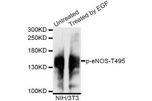 Western blot analysis of extracts of untreated and EGF-treated NIH/3T3 cells, using Phospho-eNOS-T495 antibody (ABIN5995598) at 1/1000 dilution. (ENOS Antikörper  (pTyr495))