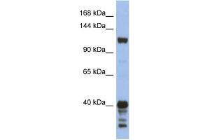 WB Suggested Anti-SIPA1 Antibody Titration: 0.