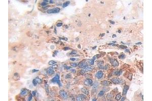 Immunohistochemistry (IHC) image for anti-Superoxide Dismutase 2, Mitochondrial (SOD2) (AA 25-222) antibody (ABIN7442672)
