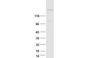 Western Blotting (WB) image for ADAM Metallopeptidase with Thrombospondin Type 1 Motif, 13 (ADAMTS13) (Transcript Variant 1) protein (Myc-DYKDDDDK Tag) (ABIN2714385)