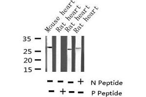 Western blot analysis of Phospho-TNNI3 (Thr142) expression in various lysates (TNNI3 Antikörper  (pThr143))