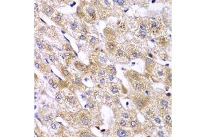 Immunohistochemistry of paraffin-embedded human liver injury using RPS10 antibody at dilution of 1:100 (x40 lens). (RPS10 Antikörper)