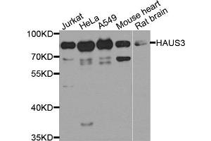 Western blot analysis of extract of various cells, using HAUS3 antibody. (HAUS3 Antikörper)