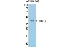 Western blot analysis of the recombinant protein. (Complement Factor I Antikörper  (AA 340-583))