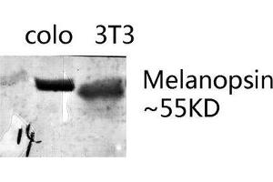 Western Blot (WB) analysis of specific lysis using Melanopsin Polyclonal Antibody.