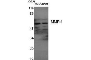 Western Blot (WB) analysis of specific cells using MMP-1 Polyclonal Antibody.