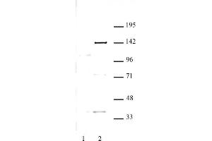 KDM4C antibody (pAb) tested by Western blot. (KDM4C Antikörper)