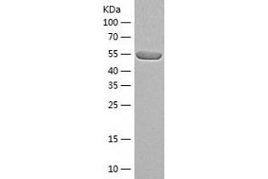 Western Blotting (WB) image for Calcineurin A (CAN) (AA 1-511) protein (His tag) (ABIN7122077) (Calcineurin A Protein (CAN) (AA 1-511) (His tag))