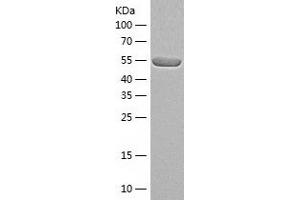 Western Blotting (WB) image for Calcineurin A (CAN) (AA 1-511) protein (His tag) (ABIN7287007) (Calcineurin A Protein (CAN) (AA 1-511) (His tag))