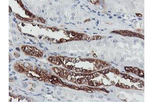 Image no. 1 for anti-phosphofructokinase, Platelet (PFKP) antibody (ABIN1500163) (PFKP Antikörper)