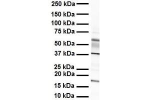 WB Suggested Anti-ZYX antibody Titration: 1 ug/mL Sample Type: Human heart (ZYX Antikörper  (Middle Region))