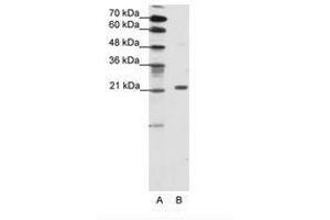 Image no. 1 for anti-Chromobox Homolog 1 (CBX1) (AA 61-110) antibody (ABIN202048)