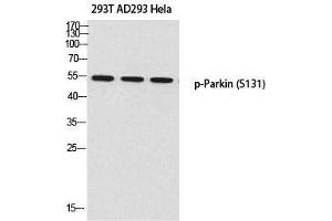 Western Blot (WB) analysis of 293T AD293 HeLa using p-Parkin (S131) antibody. (Parkin Antikörper  (pSer131))