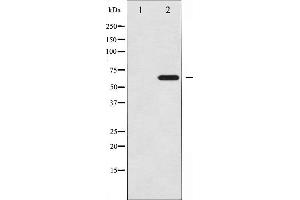 Western blot analysis of Ezrin expression in EGF treated A431 whole cell lysates,The lane on the left is treated with the antigen-specific peptide.