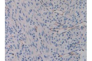 Used in DAB staining on fromalin fixed paraffin- embedded liver tissue (Integrin beta 3 Antikörper  (AA 134-376))