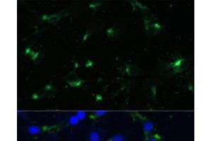 Immunofluorescence analysis of NIH-3T3 cells using ENO1 Polyclonal Antibody at dilution of 1:100. (ENO1 Antikörper)