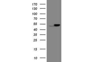 Image no. 1 for anti-Epoxide Hydrolase 1, Microsomal (Xenobiotic) (EPHX1) (AA 21-230) antibody (ABIN1491195) (EPHX1 Antikörper  (AA 21-230))