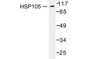 Image no. 2 for anti-Heat Shock 105kDa/110kDa Protein 1 (HSPH1) antibody (ABIN265469) (HSPH1 Antikörper)