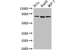 Western Blot Positive WB detected in: Hela whole cell lysate, HepG2 whole cell lysate, MCF-7 whole cell lysate All lanes: IMMT antibody at 3. (IMMT Antikörper  (AA 76-215))