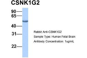 Host: Rabbit  Target Name: CSNK1G2  Sample Tissue: Human Fetal Brain  Antibody Dilution: 1. (Casein Kinase 1 gamma 2 Antikörper  (Middle Region))