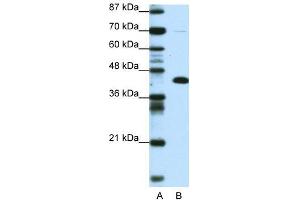 Transfected 293T; WB Suggested Anti-ZBTB25 Antibody Titration: 0. (ZBTB25 Antikörper  (Middle Region))