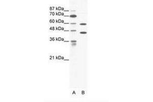 Image no. 1 for anti-Cation Channel, Sperm Associated 2 (CATSPER2) (C-Term) antibody (ABIN203196) (CATSPER2 Antikörper  (C-Term))