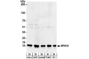 anti-Ribosomal Protein S19 (RPS19) (AA 95-145) antibody